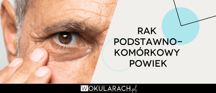 Rak podstawnokomórkowy powiek