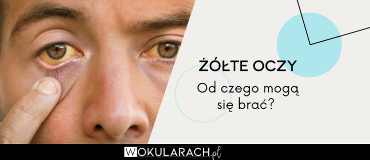 Żółte oczy – od czego mogą się brać?