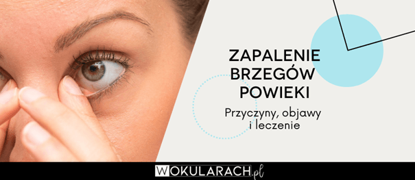 Zapalenie brzegów powiek - przyczyny, objawy i leczenie