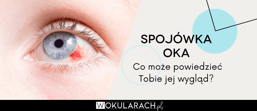 Spojówka oka – co może powiedzieć Tobie jej wygląd?