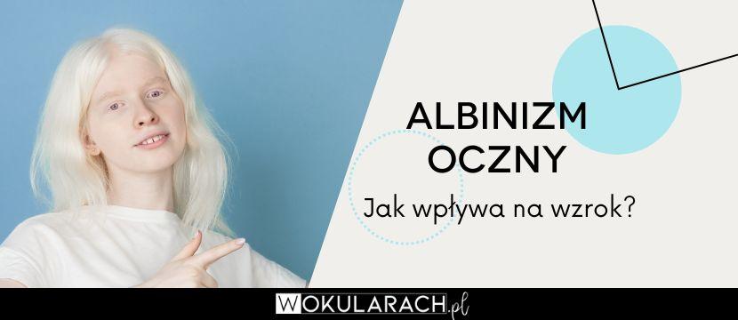 Albinizm oczny – jak wpływa na wzrok?