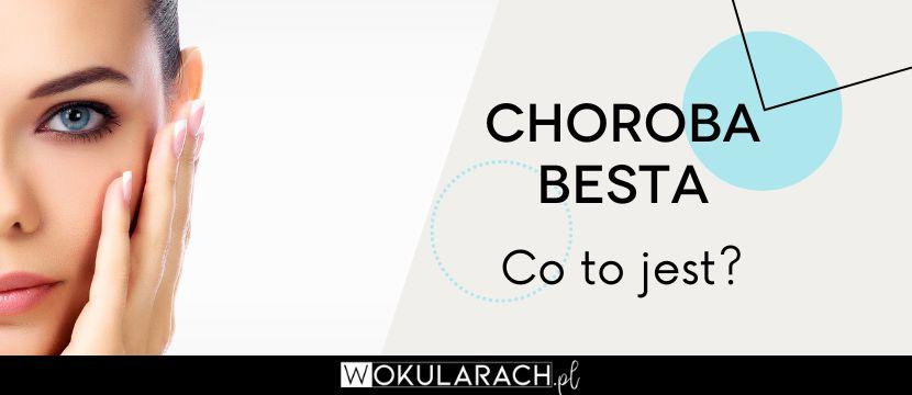 Choroba Besta – co to jest?