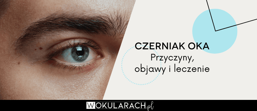 Czerniak oka – objawy, przyczyny i leczenie