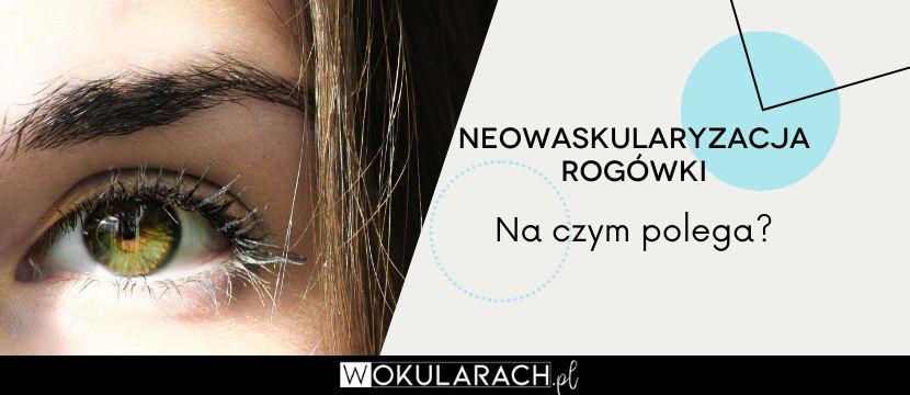 Neowaskularyzacja rogówki – na czym polega?